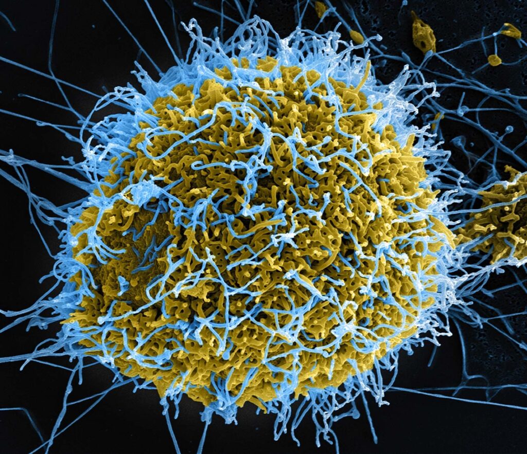 Ebola in Nigeria